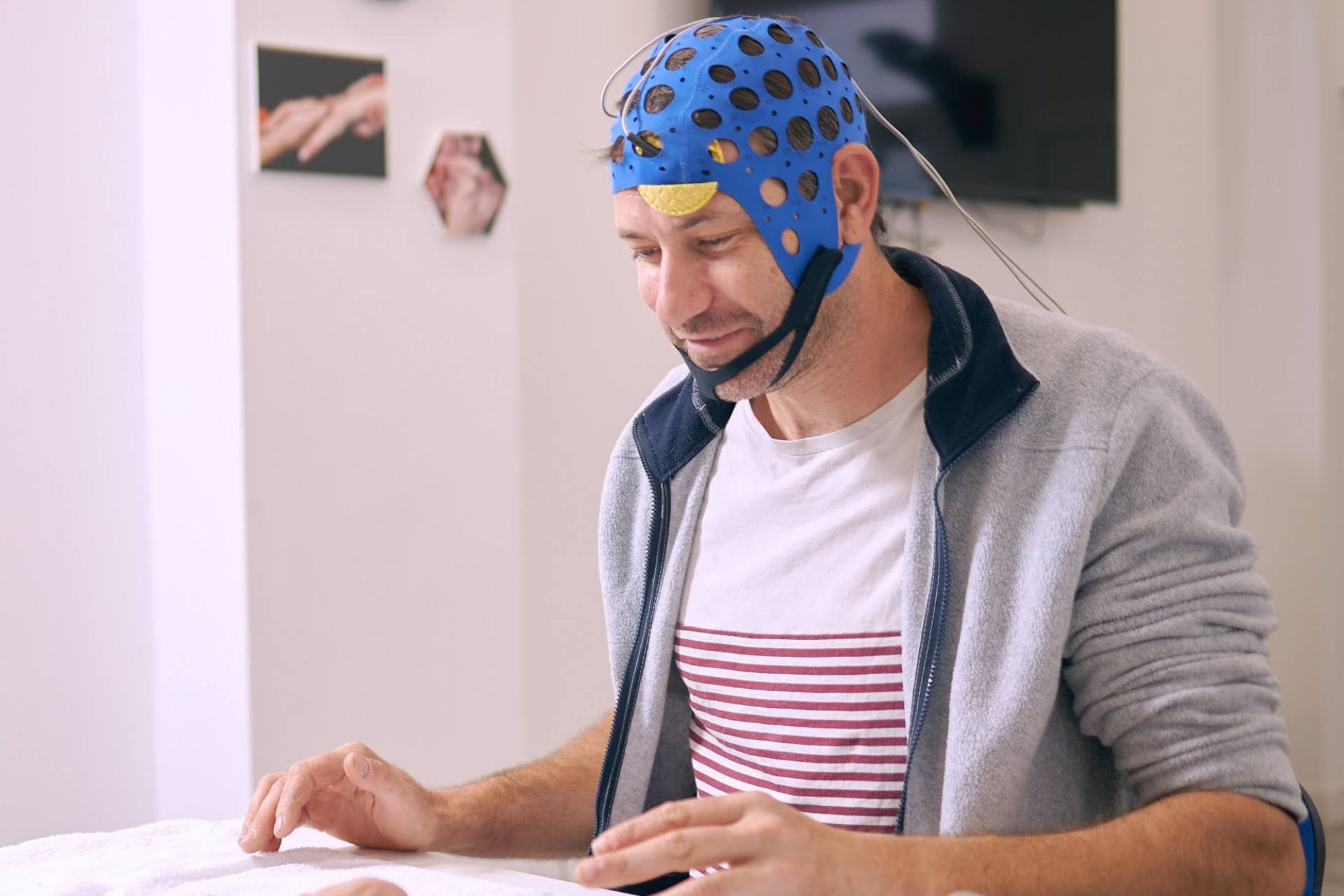 Estimulación Transcraneal Corriente Directa TDCS | Ionclinics